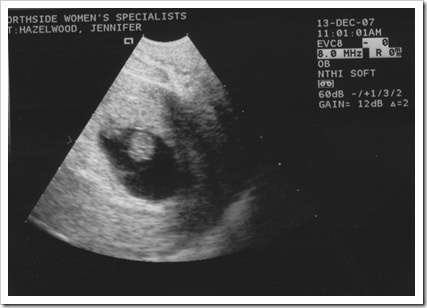Ultrasound1-Dec13